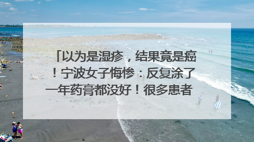 以为是湿疹，结果竟是癌！宁波女子悔惨：反复涂了一年药膏都没好！很多患者首诊都去了皮肤科