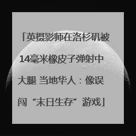 英摄影师在洛杉矶被14毫米橡皮子弹射中大腿 当地华人：像误闯“末日生存”游戏